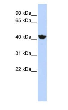 ADH4 Antibody (aa108-157)
