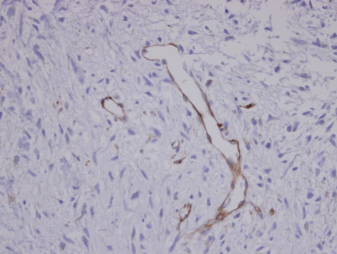 Polyclonal Rabbit anti-Human CORO1C Antibody (aa411-474, IHC, WB)