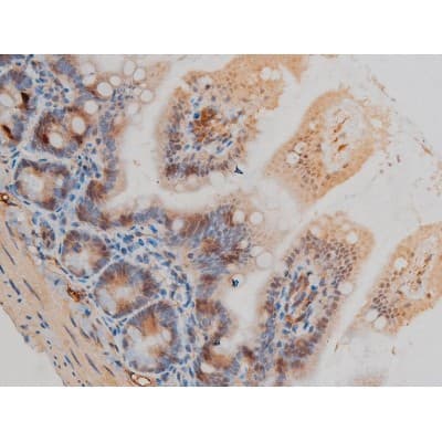 Polyclonal Rabbit anti-Human GFAP Antibody (phospho-Ser38, IHC, IF, WB)