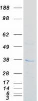 Human FN3KL / FN3KRP Protein (Recombinant Myc-DDK (Flag))