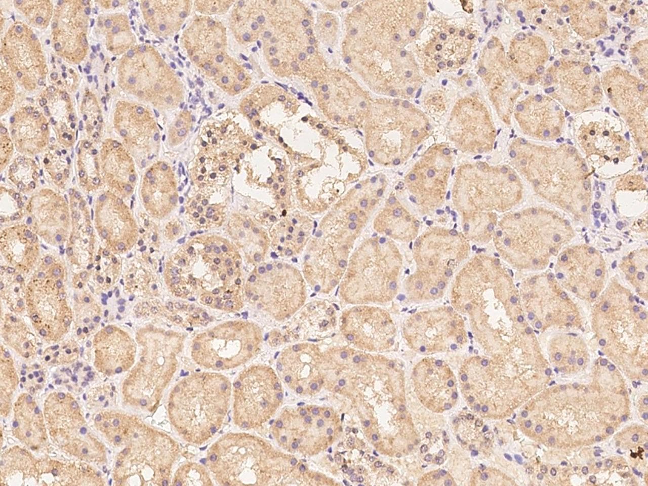 Polyclonal Rabbit anti-Human OR52I2 Antibody (IHC)