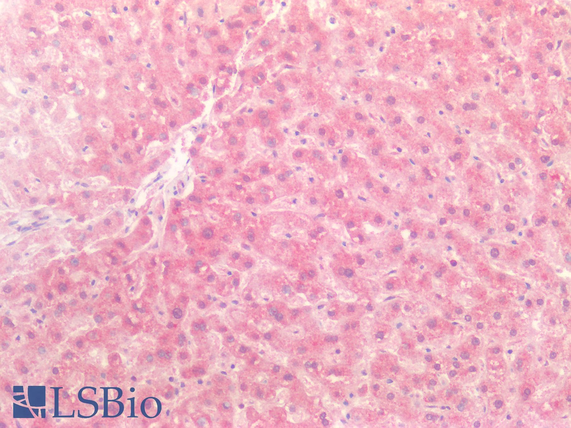 IHC-plus™ Polyclonal Rabbit anti-Human CTSK / Cathepsin K Antibody (IHC)
