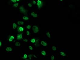 TP53 / p53 Antibody (clone OTI1D11, Carrier-free)