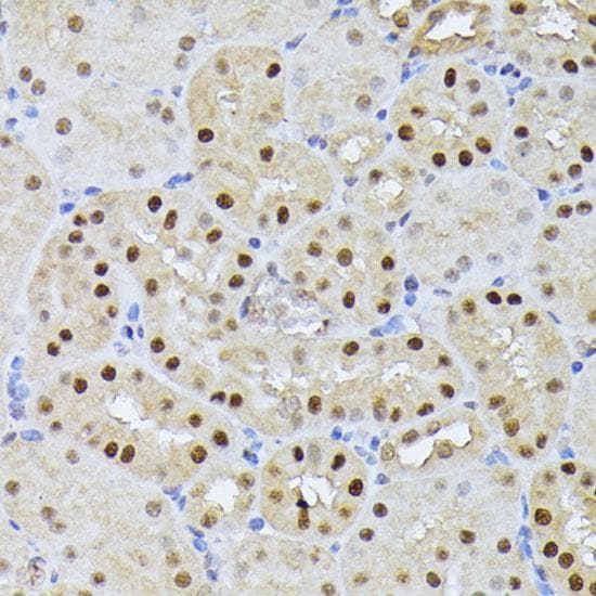 Polyclonal Rabbit anti-Human RPS27A Antibody (IHC)