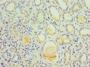IL1R1 Antibody (aa18-320)