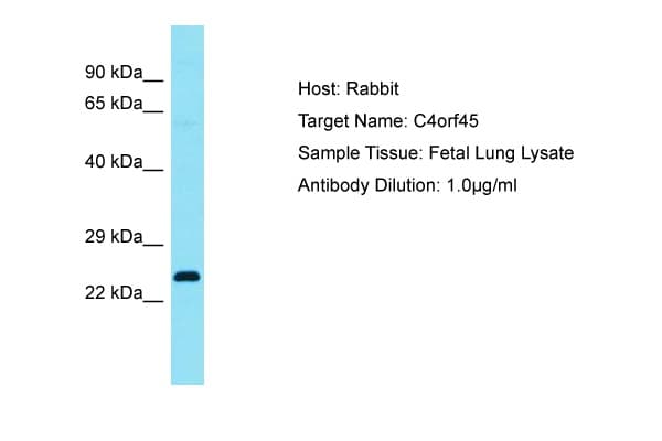 Polyclonal Rabbit anti-Human C4orf45 Antibody (C-Terminus, WB)