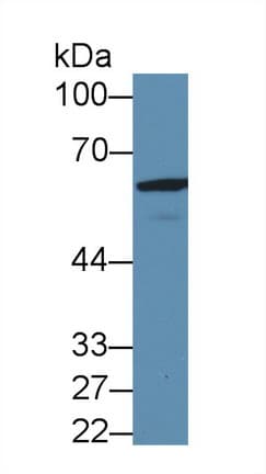 GAD65 Antibody (aa65-105)