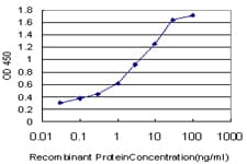 TGM2 / Transglutaminase 2 Antibody (clone 2F4)