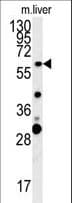 Polyclonal Rabbit anti-Human ZCCHC5 Antibody (aa38-67, WB)