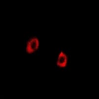 PathPlus™ Polyclonal Rabbit anti-Human HSPA9 / Mortalin / GRP75 Antibody (IHC, IF, WB)