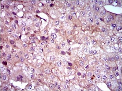 Monoclonal Mouse anti-Human SHH / Sonic Hedgehog Antibody (clone 5H4, Amino Acid: 26-161, IHC, WB)