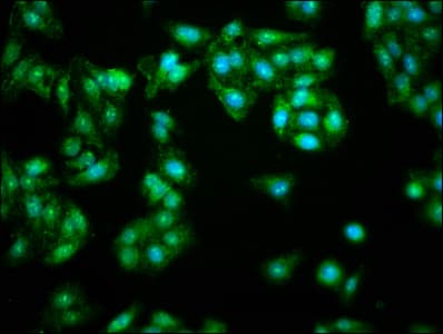 Bis(5'-adenosyl)-triphosphatase Antibody