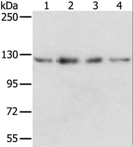 RBM5 / G15 Antibody