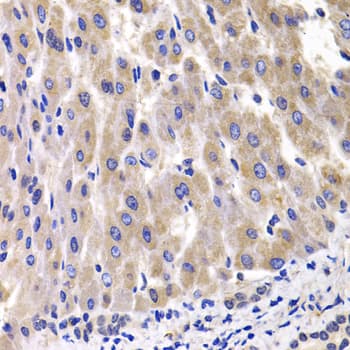 RPL14 / Ribosomal Protein L14 Antibody