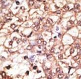 Polyclonal Rabbit anti-Human KREMEN1 / KREMEN-1 Antibody (aa6-37, IHC, WB)