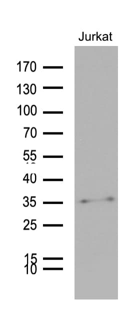 GTPCH1 / GCH1 Antibody (clone OTI7B8)