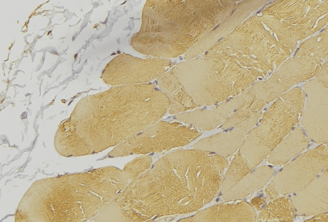 Polyclonal Rabbit anti-Human PTP1B Antibody (IHC, IF, WB)