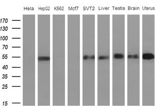 APOH / Apolipoprotein H Antibody (aa120-345, clone OTI4A11)