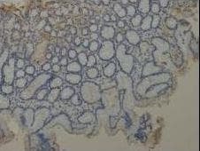 EMA / MUC1 Antibody (aa1192-1241)