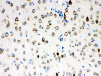 ATXN2 / SCA2 / Ataxin-2 Antibody