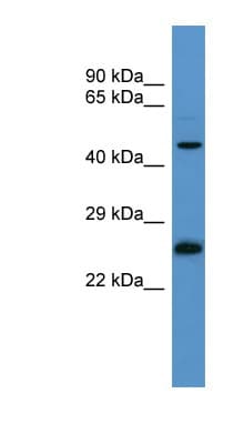 RAB8B Antibody (aa104-153)