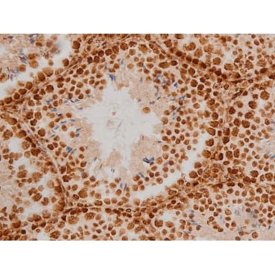 Polyclonal Rabbit anti-Human EZR / Ezrin Antibody (phospho-Tyr353, IF, WB)