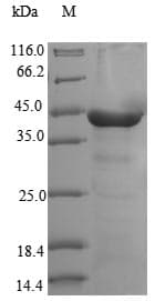 Human DYNC2LI1 / D2LIC Protein (Recombinant 10His, N-terminus + Myc, C-terminus)