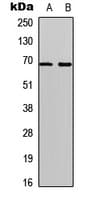 MAP3K7 / TAK1 Antibody (phospho-Thr184)