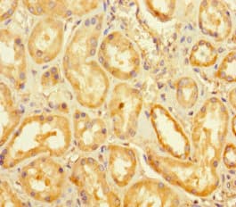 KDM1B Antibody