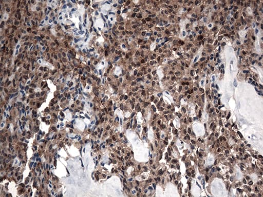 Monoclonal Mouse anti-Human CSTB / Cystatin B / Stefin B Antibody (clone OTI2A7, aa1-98, IHC, WB)