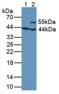 Aspartate Aminotransferase Antibody