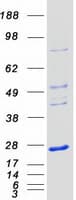 Human NKIRAS1 Protein (Recombinant Myc-DDK (Flag))