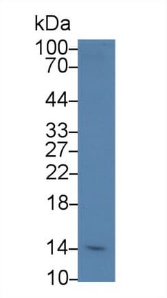 SH2D1A / SAP Antibody (aa18-115)