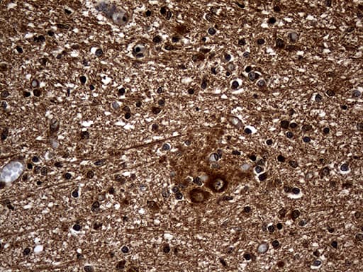 GNPAT / DHAP-AT Antibody (clone OTI1H1)