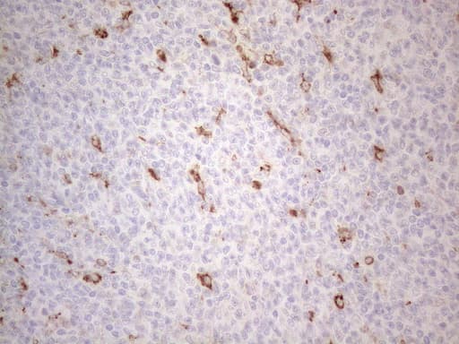 GRN / Granulin Antibody (aa327-593, clone OTI4B9)