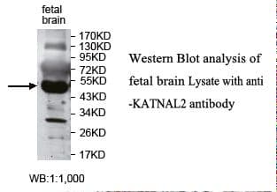 KATNAL2 Antibody (aa263-424)