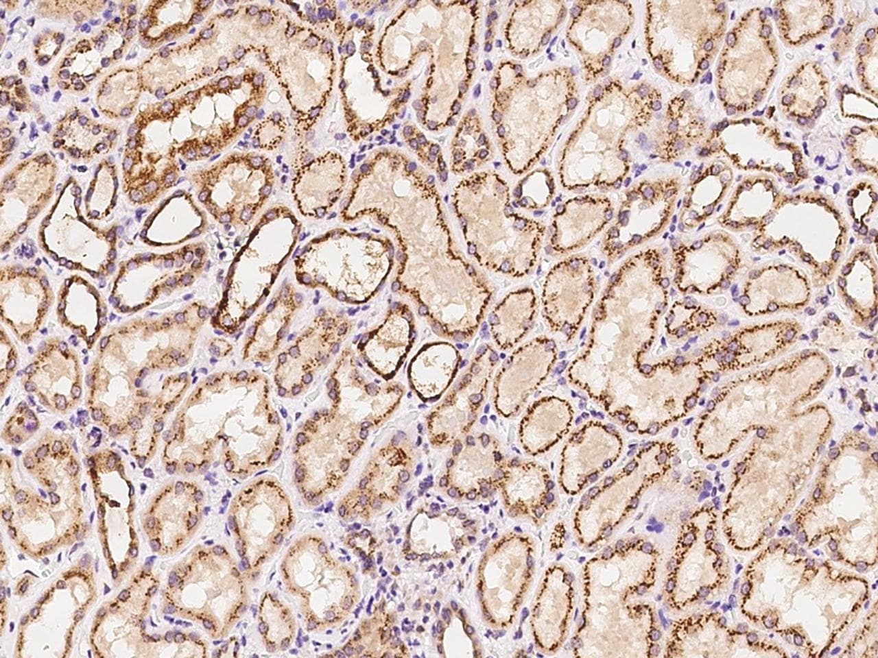 CYP1B1 Antibody