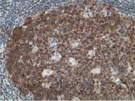 DCK / Deoxycytidine kinase Antibody (clone OTI16G6, Carrier-free)
