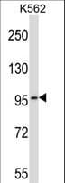 PDE6A / PDE6 Alpha Antibody (aa308-336)