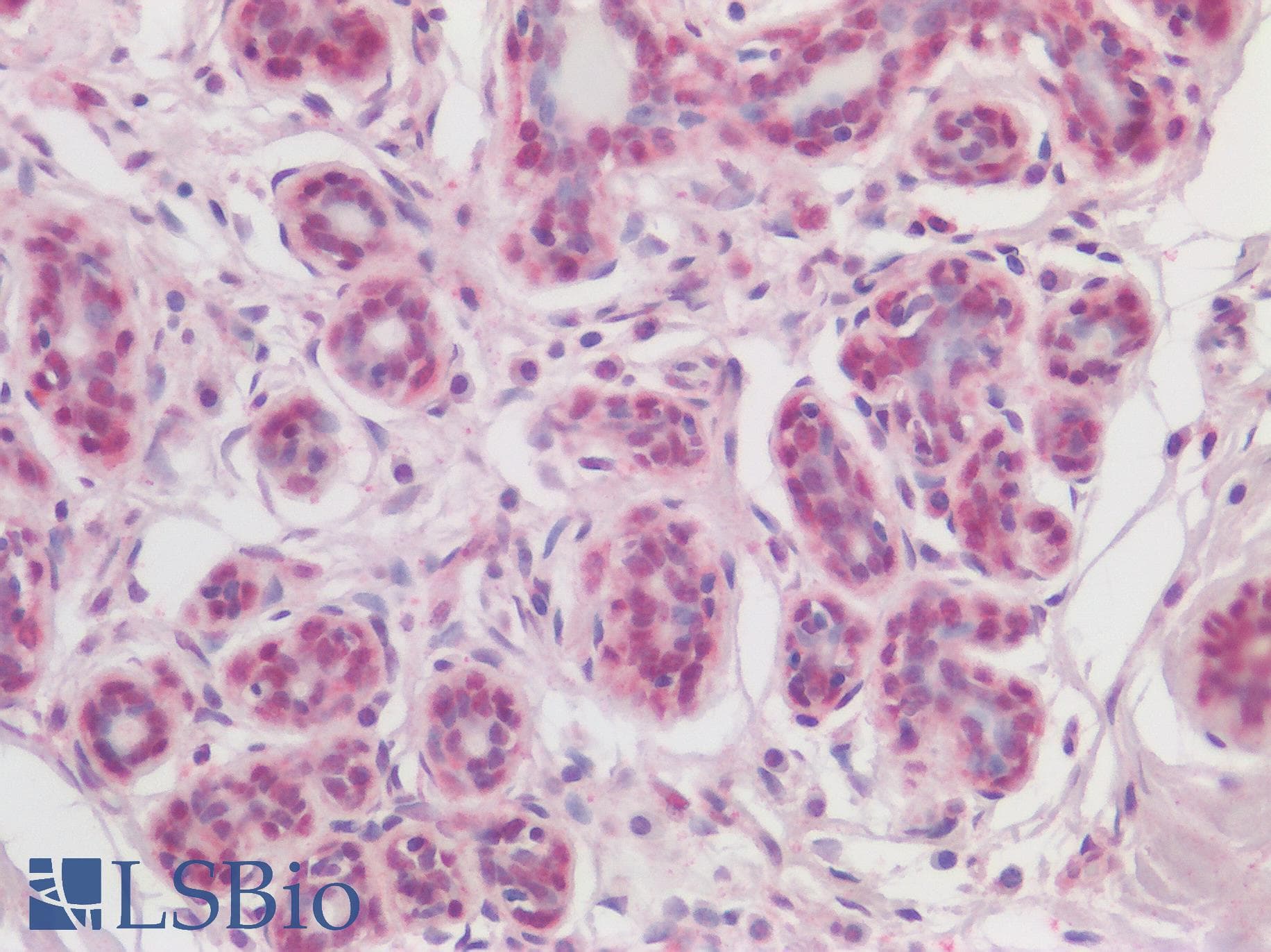 IHC-plus™ Polyclonal Rabbit anti-Human DKK1 Antibody (Internal Region, IHC, WB)