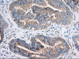 IGF2BP2 Antibody (clone OTI5G3)