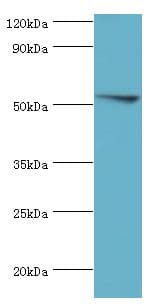 FKBP4 / FKBP52 Antibody (aa220-459)