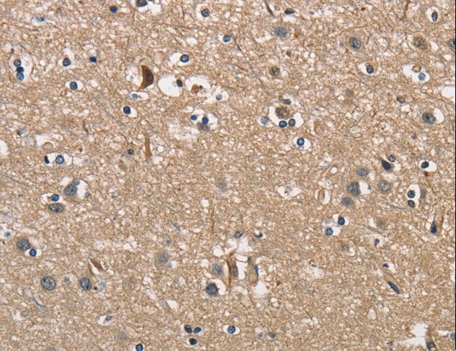PGK1 / Phosphoglycerate Kinase Antibody