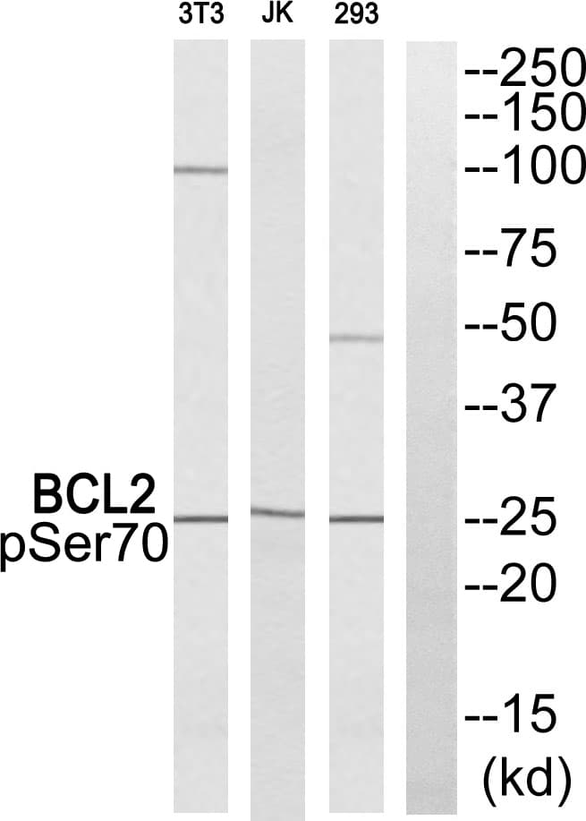BCL2 / Bcl-2 Antibody (phospho-Ser70)