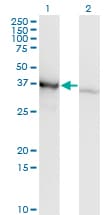 HnRNP-E1 / PCBP1 Antibody (clone 1G2)