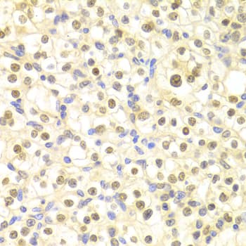 Polyclonal Rabbit anti-Human DDB2 Antibody (IHC, IF, WB)