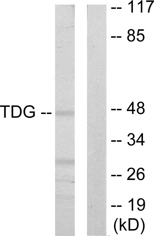 TDG / Thymine DNA Glycosylase Antibody (aa31-80)