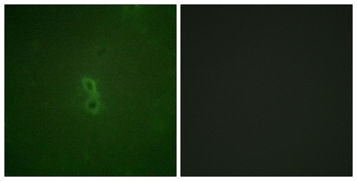 BCL2L1 / BCL-XL Antibody (phospho-Thr47)