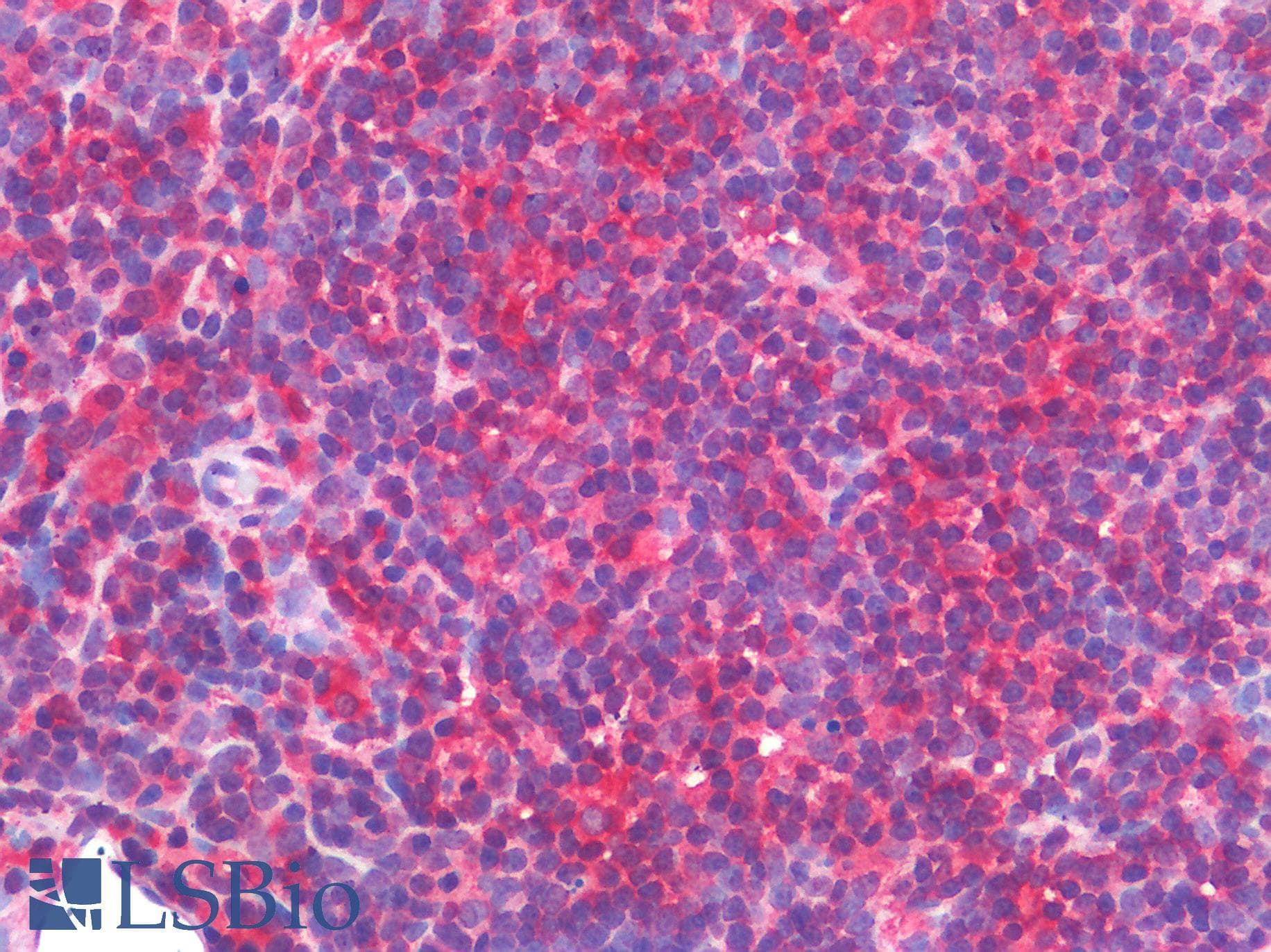 IHC-plus™ CD45 / LCA Antibody