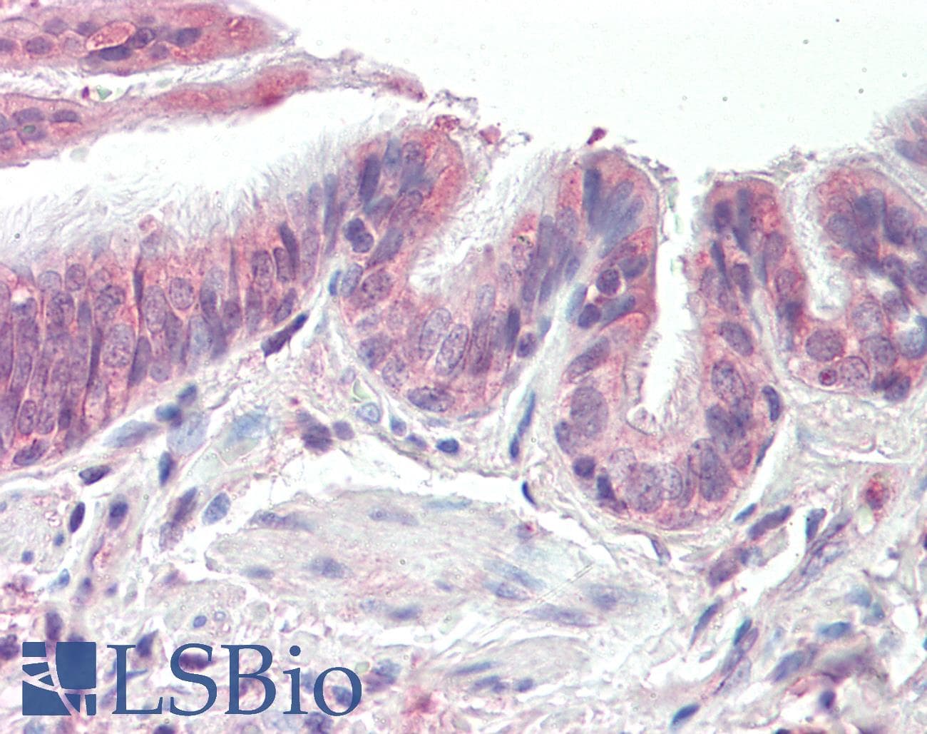 IHC-plus™ Polyclonal Goat anti-Human PSMB3 Antibody (aa72-81, IHC, WB)